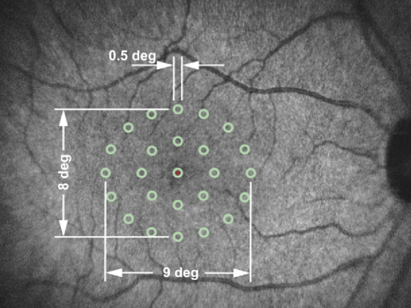 用于多光子顯微鏡和生物光子學(xué)的強大飛秒激光器