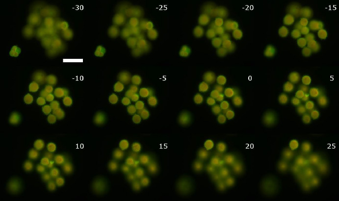 通過(guò)一組花粉粒進(jìn)行基于 ETL 的聚焦